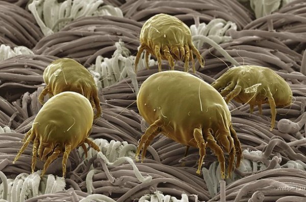 как выглядит пыль под микроскопом